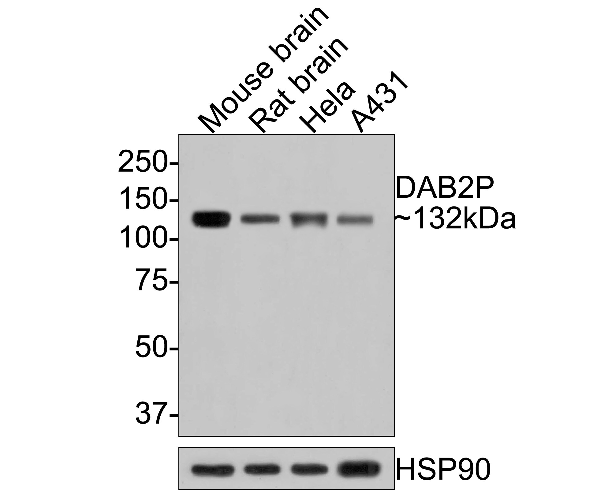 DAB2IP Antibody