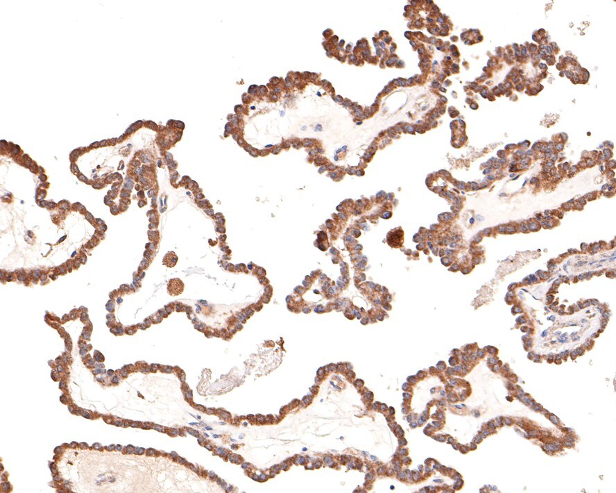 DAB2IP Antibody