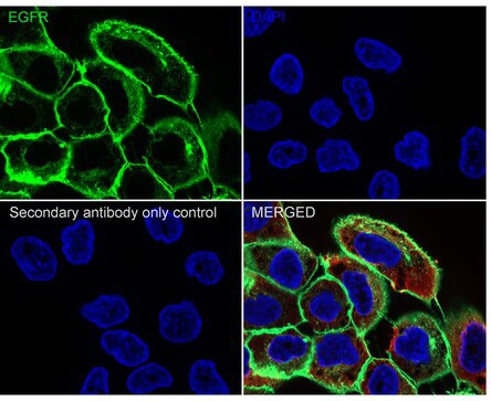 EGFR Antibody (PD00-75)