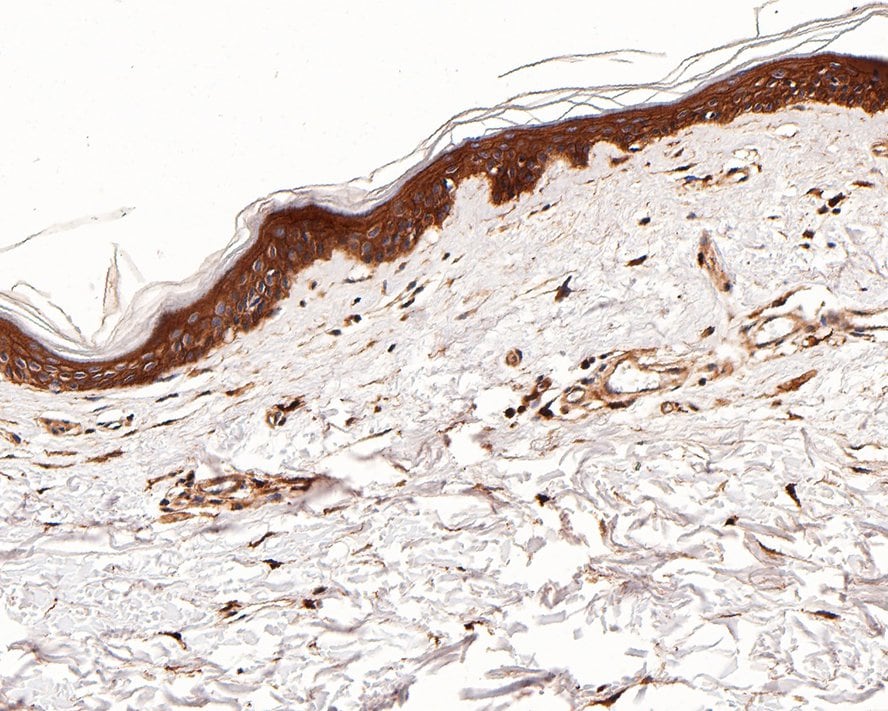 EGFR Antibody (PD00-75)