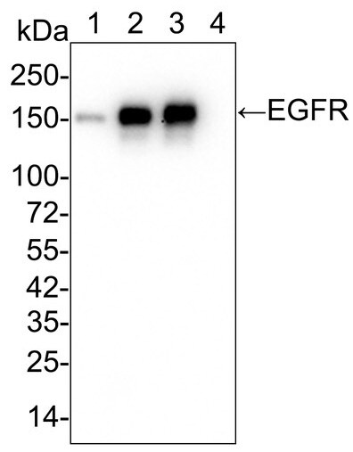 EGFR Antibody (PD00-75)