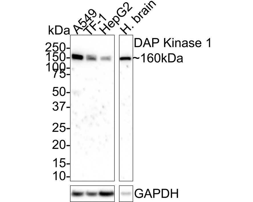 DAP Kinase 1 Antibody (12B2-R) Western Blot: DAP Kinase 1 Antibody (12B2-R) [NBP3-32256]