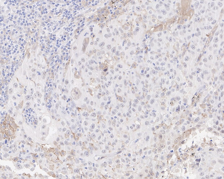 DAP Kinase 1 Antibody (12B2-R)