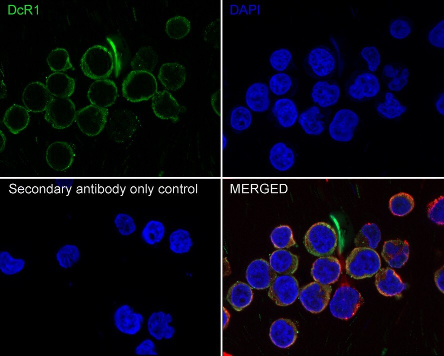 TRAILR3/TNFRSF10C Antibody (JE58-51)
