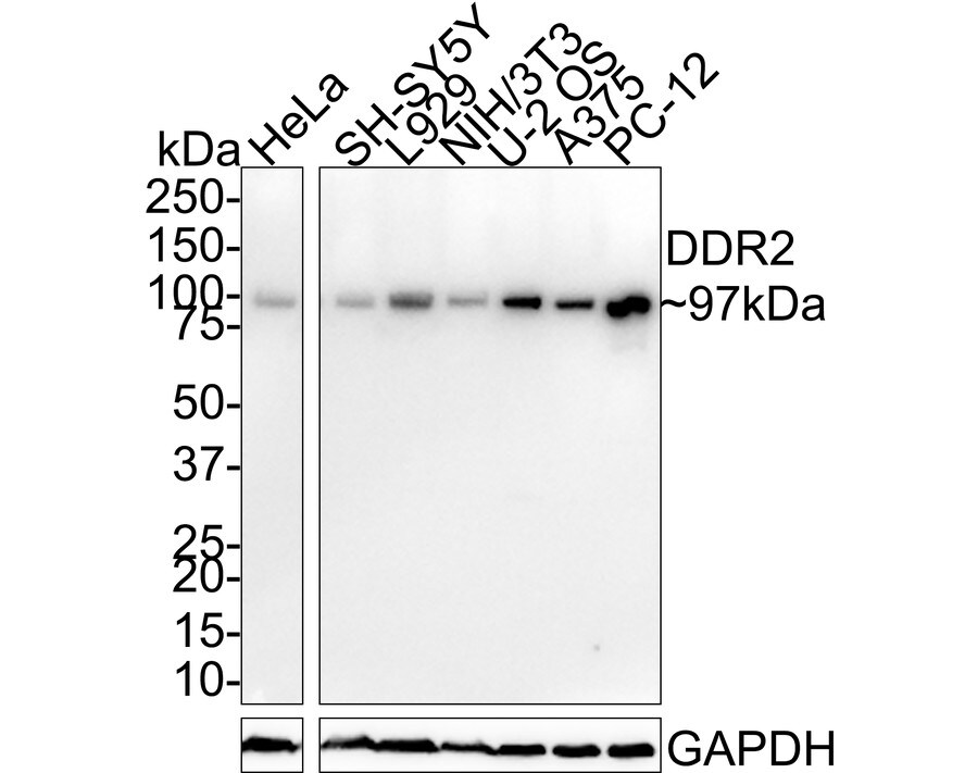 DDR2 Antibody (JE31-45)