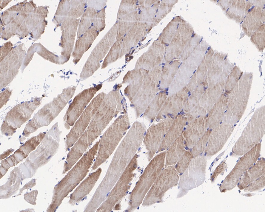 DDR2 Antibody (JE31-45)