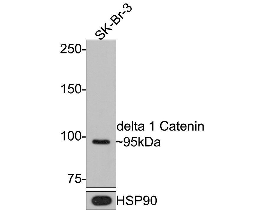 p120-catenin Antibody (PD00-43) Western Blot: p120-catenin Antibody (PD00-43) [NBP3-32263]