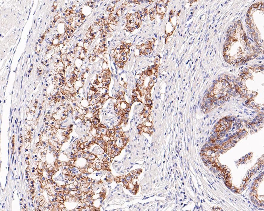 p120-catenin Antibody (PD00-43)