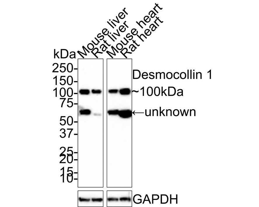 Desmocollin-1 Antibody (JE66-57) Western Blot: Desmocollin-1 Antibody (JE66-57) [NBP3-32264]