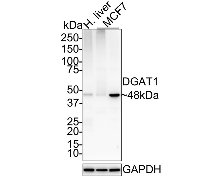 DGAT1 Antibody (JE34-88) Western Blot: DGAT1 Antibody (JE34-88) [NBP3-32265]