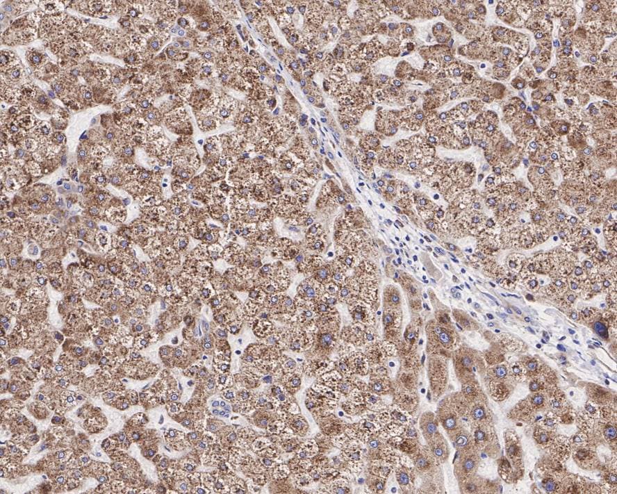 DGAT1 Antibody (JE34-88)