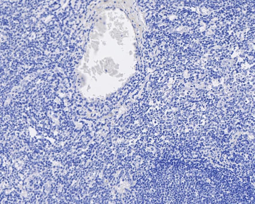 Digoxigenin Antibody (PSH04-39)