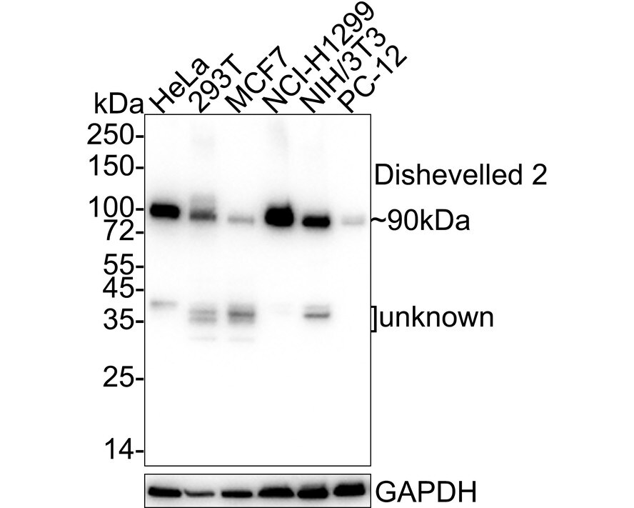 Dishevelled-2 Antibody (PSH04-07) Western Blot: Dishevelled-2 Antibody (PSH04-07) [NBP3-32269]