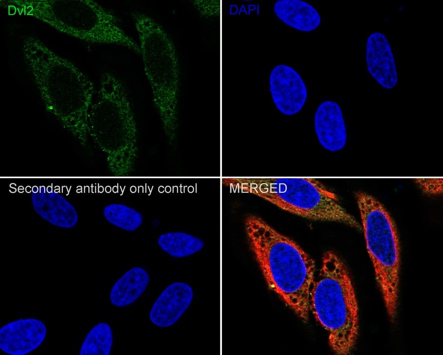 Dishevelled-2 Antibody (PSH04-07)