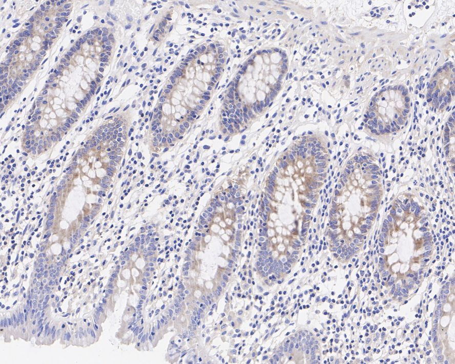 Dishevelled-2 Antibody (PSH04-07)