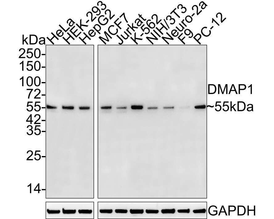 DMAP1 Antibody (JE55-31) Western Blot: DMAP1 Antibody (JE55-31) [NBP3-32271]