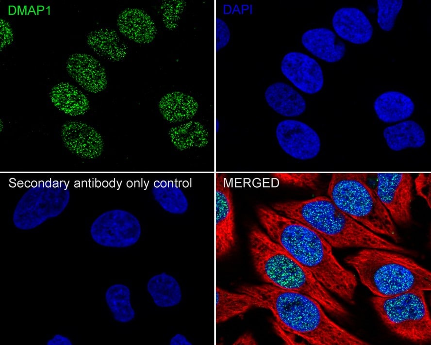 DMAP1 Antibody (JE55-31)