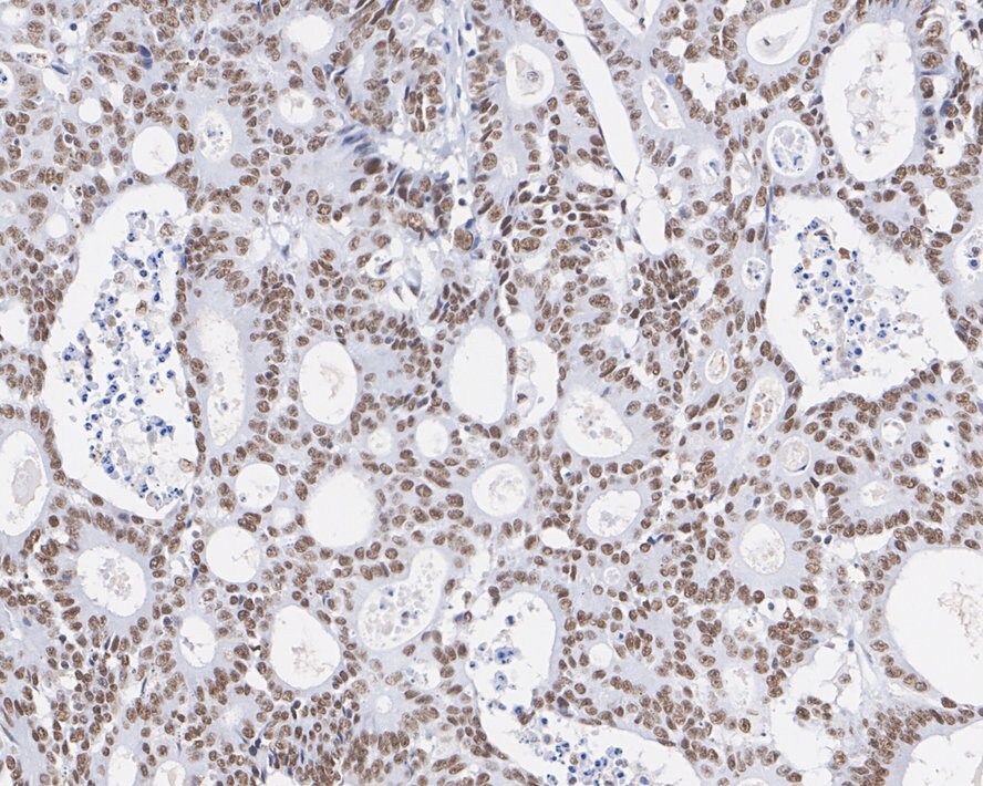 DNA-PKcs Antibody (2-B3-R)