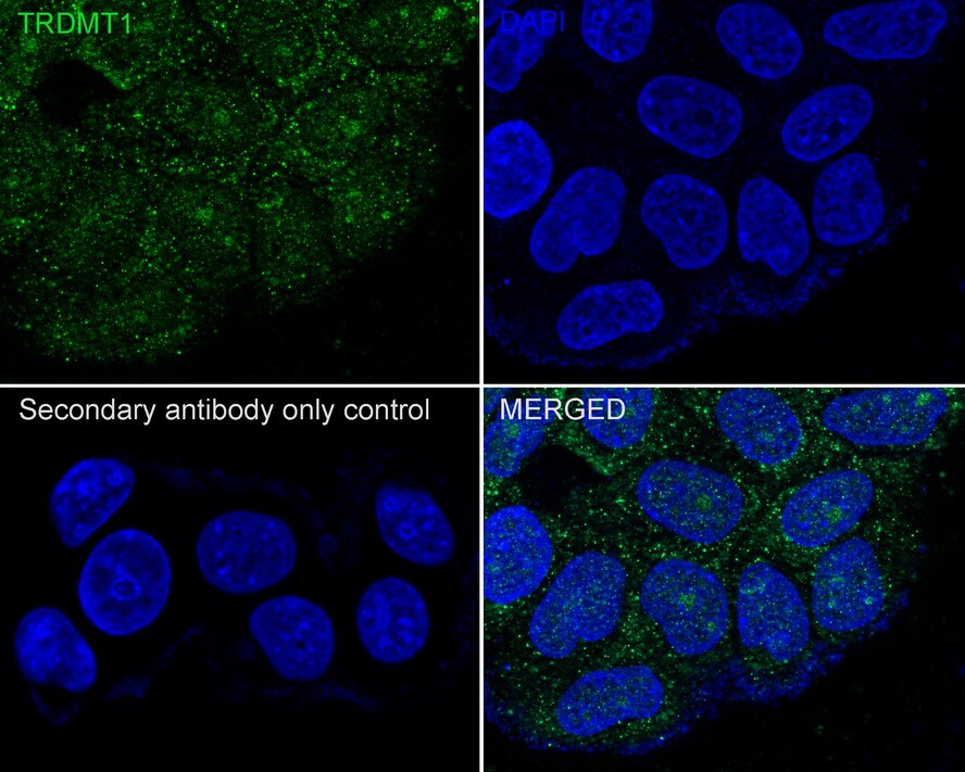 Dnmt2 Antibody (PSH03-43)