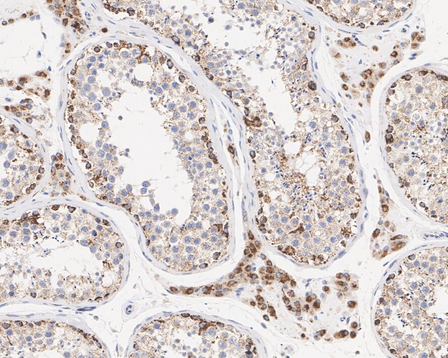 Dnmt2 Antibody (PSH03-43)
