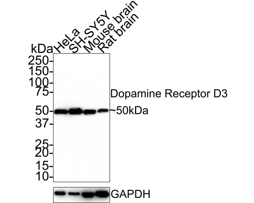 Dopamine D3R/DRD3 Antibody (JE33-33)