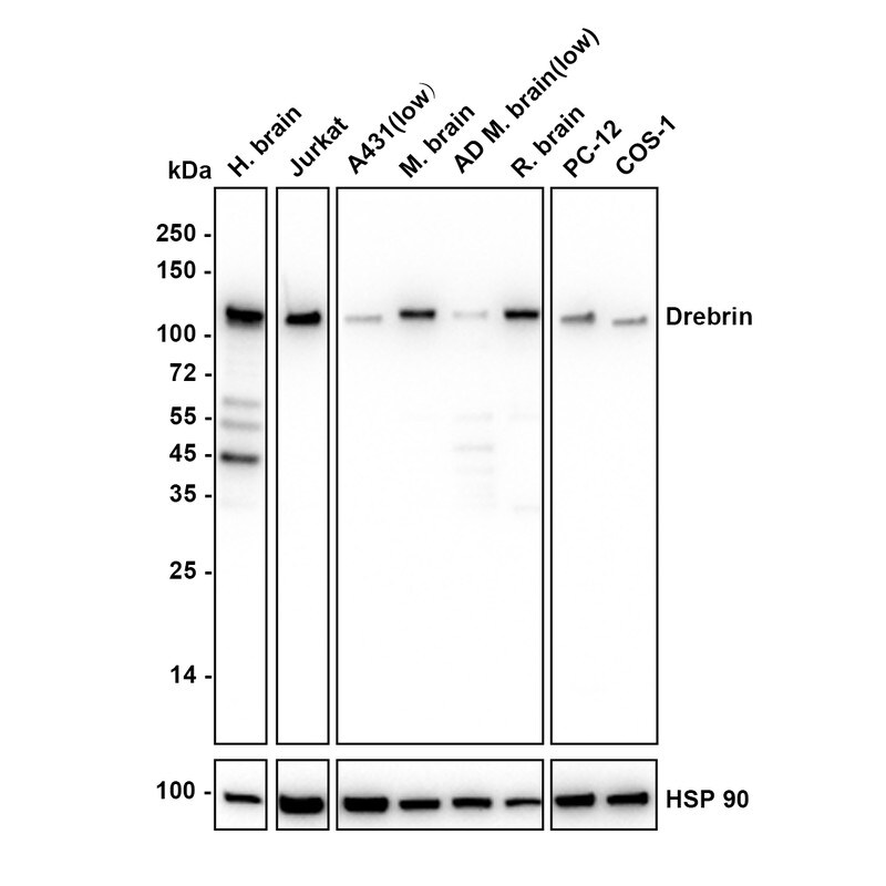 Drebrin 1 Antibody (JE30-20) Western Blot: Drebrin 1 Antibody (JE30-20) [NBP3-32279]