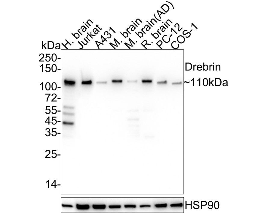 Drebrin 1 Antibody (JE30-20)