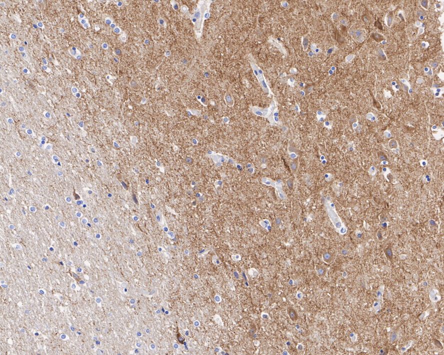 Drebrin 1 Antibody (JE30-20)