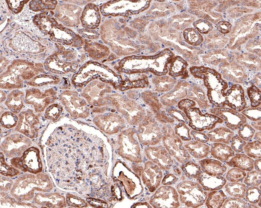 DTYMK Antibody (JE64-08)