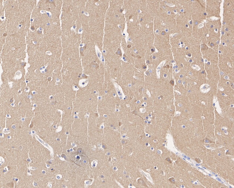 Dynamin Antibody (A1B2-R)
