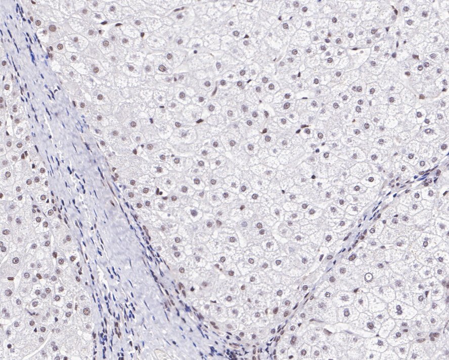 E2F-4 Antibody (JE40-78)