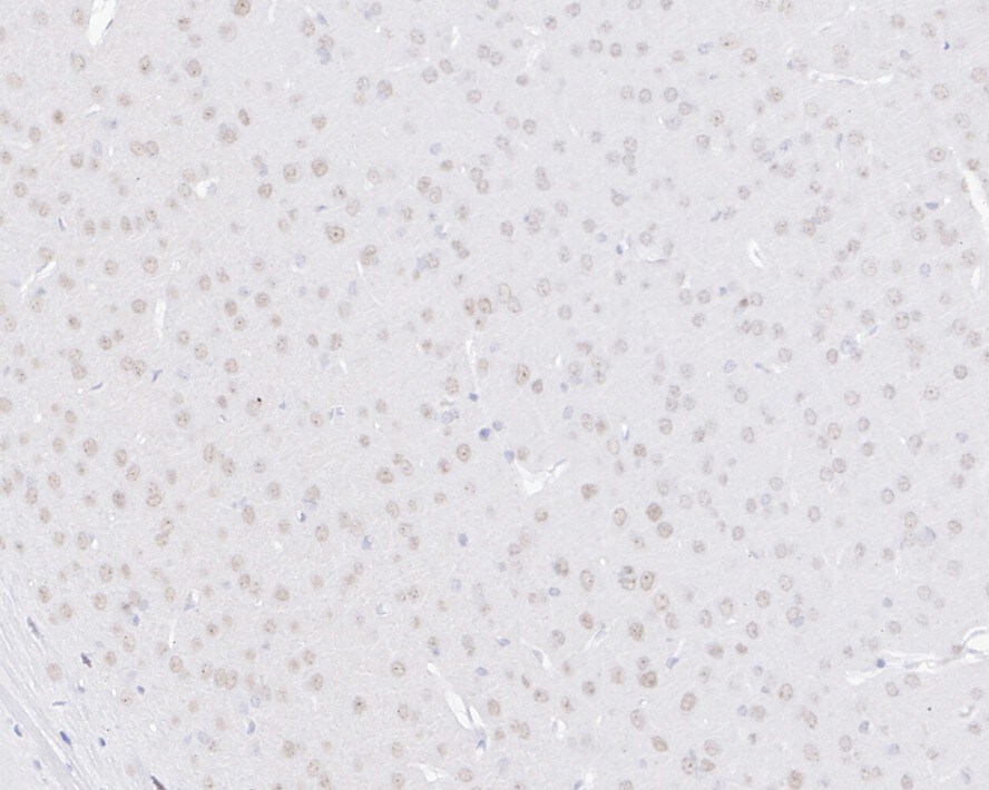 E2F6 Antibody (JE33-69)