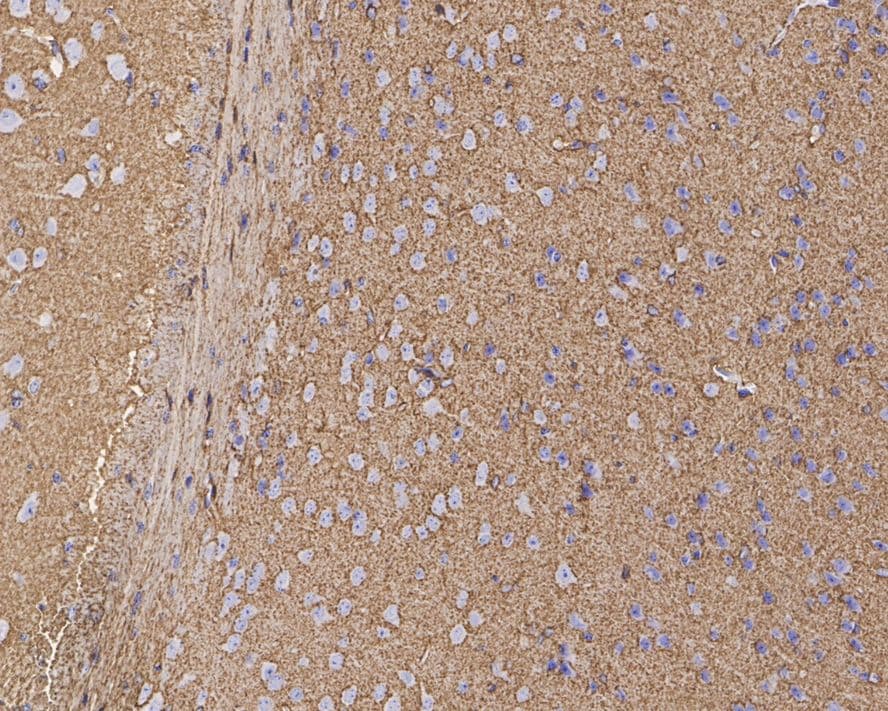 EAAT2/GLT1 Antibody (PS01-62)
