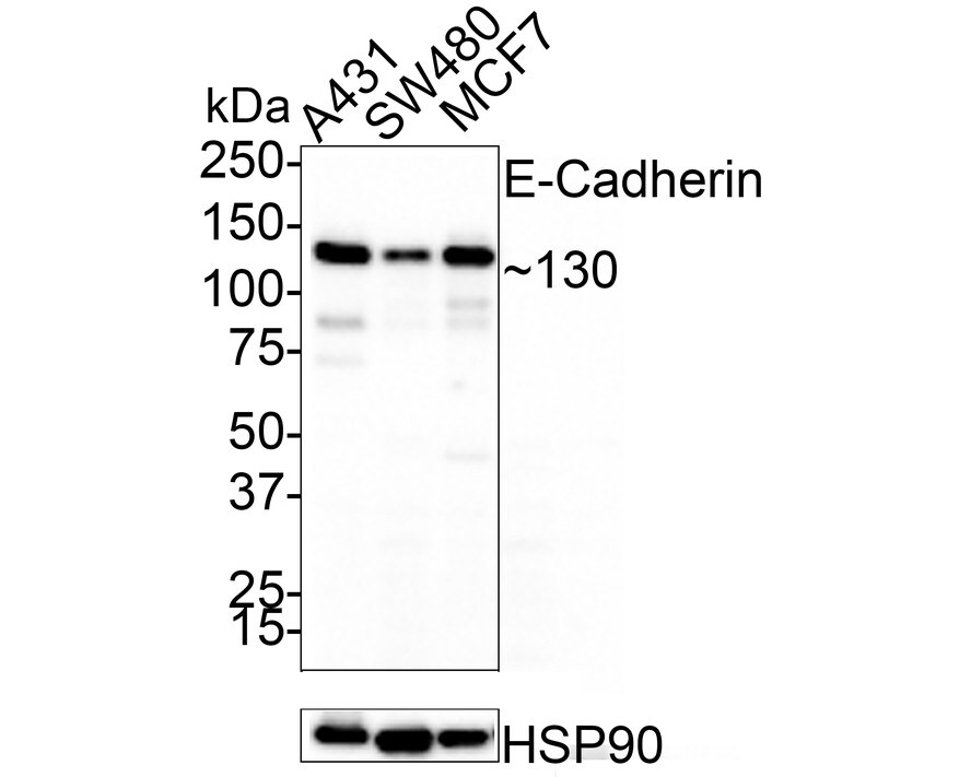 E-Cadherin Antibody (A0-G11-2-R)