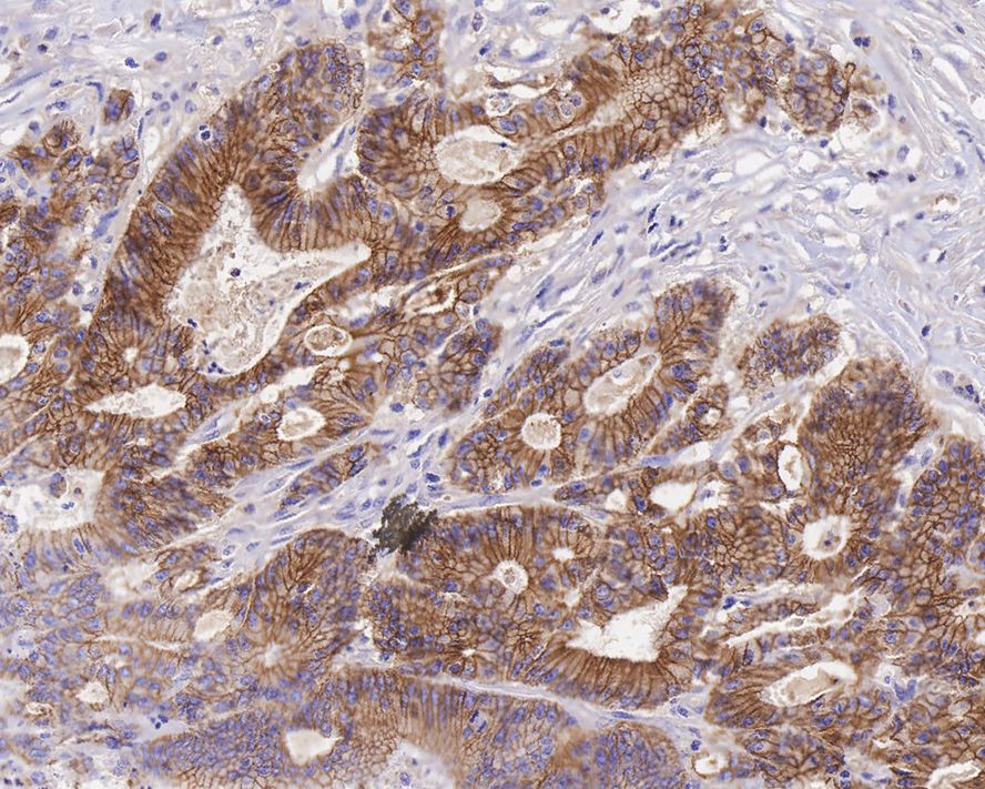 E-Cadherin Antibody (A0-G11-2-R)