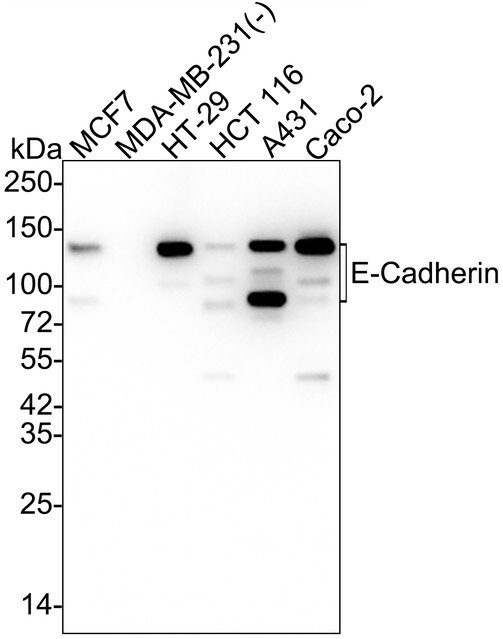 E-Cadherin Antibody (SY0287) Western Blot: E-Cadherin Antibody (SY0287) [NBP3-32290]