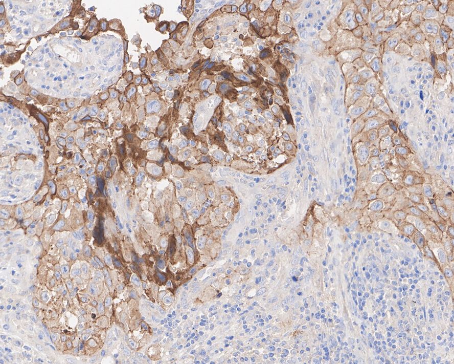 E-Cadherin Antibody (SY0287)