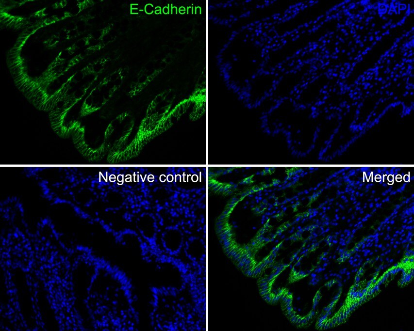 E-Cadherin Antibody (SY0287)