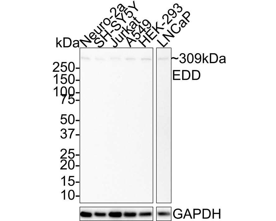 UBR5/EDD Antibody (JE38-53) Western Blot: UBR5/EDD Antibody (JE38-53) [NBP3-32291]