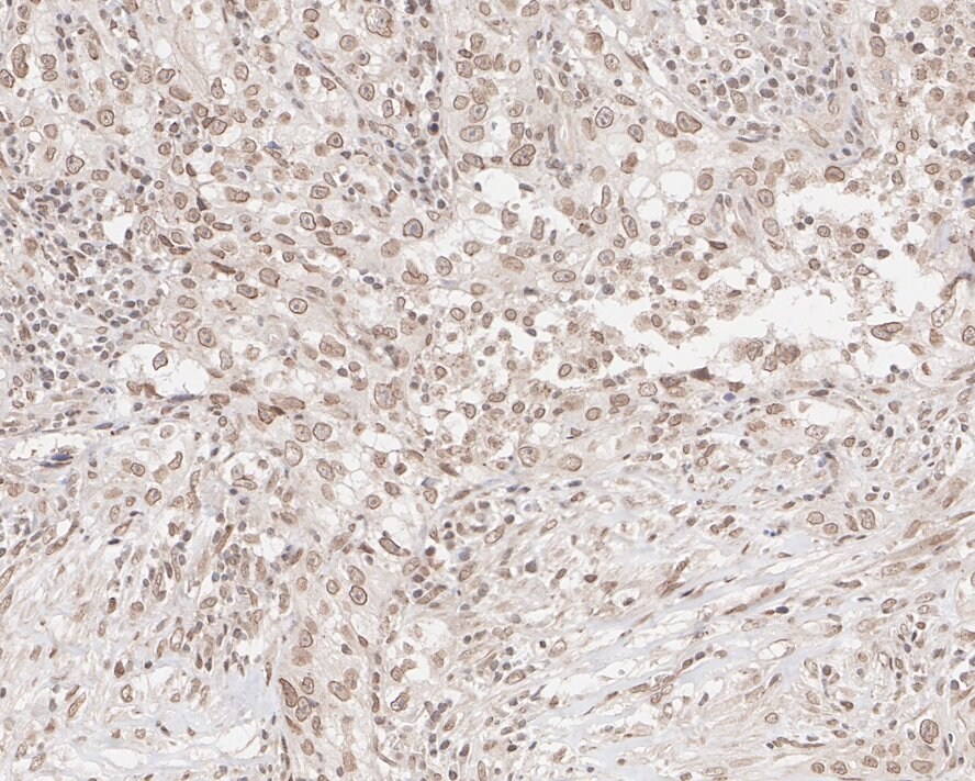 UBR5/EDD Antibody (JE38-53)