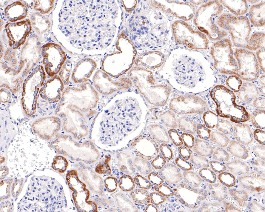 TSFM Antibody (JE64-29)