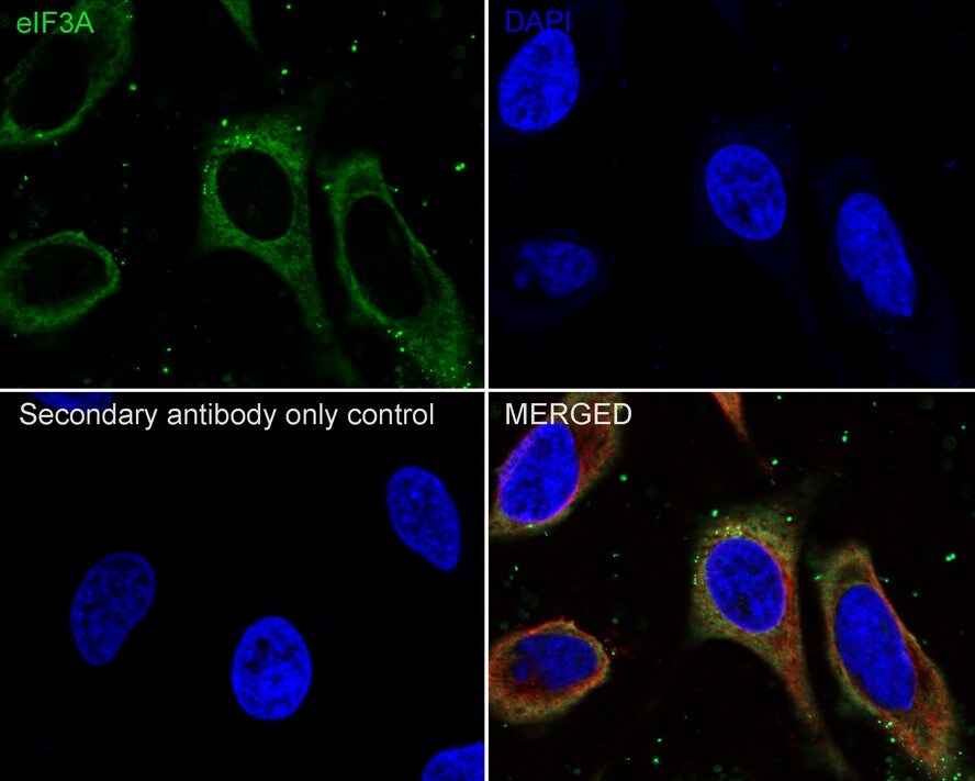 EIF3A Antibody (JE58-60)