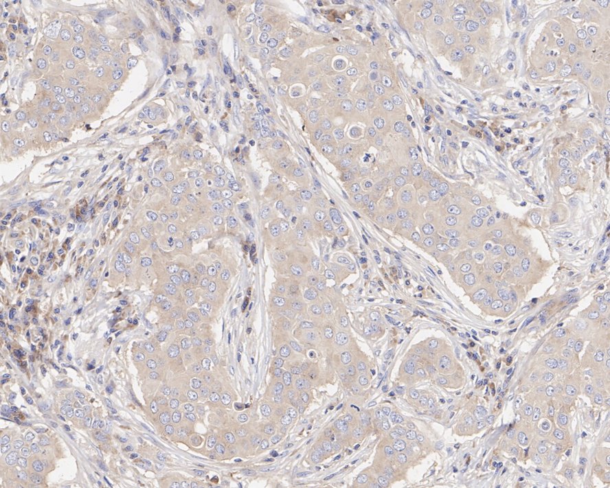 EIF3S3 Antibody (PSH04-49)