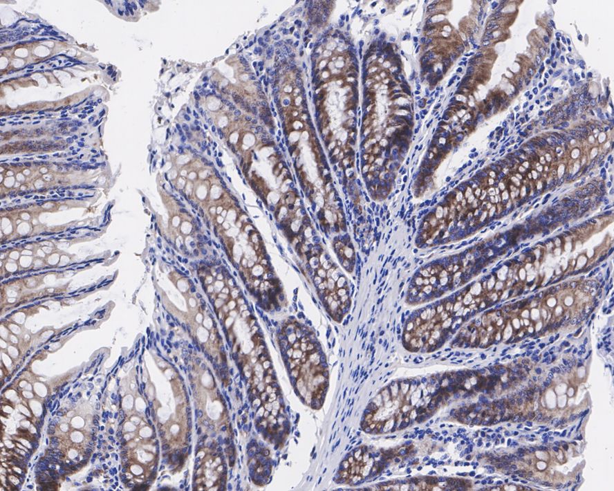 eIF4A1 Antibody (JE35-43)