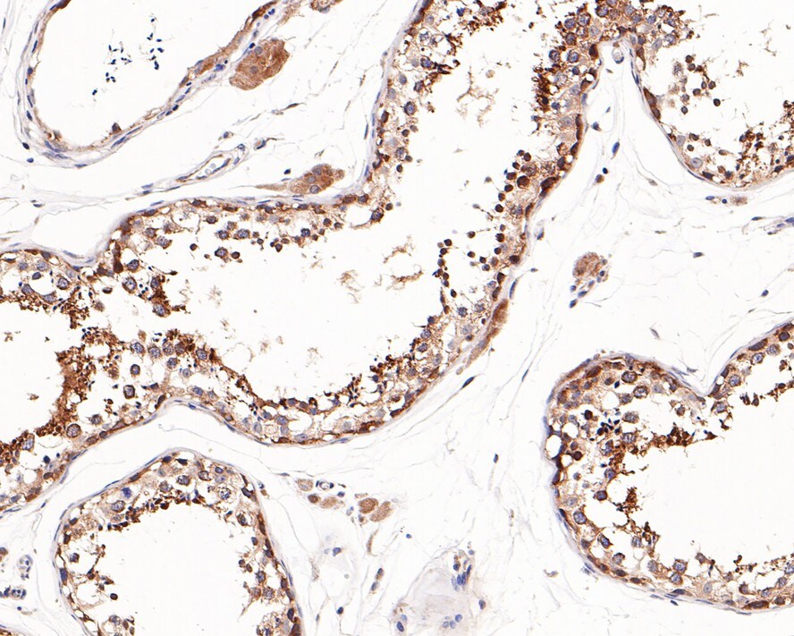 eIF4E Antibody (JE60-70)