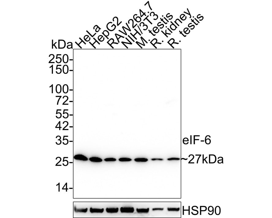 integrin beta 4 binding protein Antibody (A6A3-R) Western Blot: integrin beta 4 binding protein Antibody (A6A3-R) [NBP3-32303]