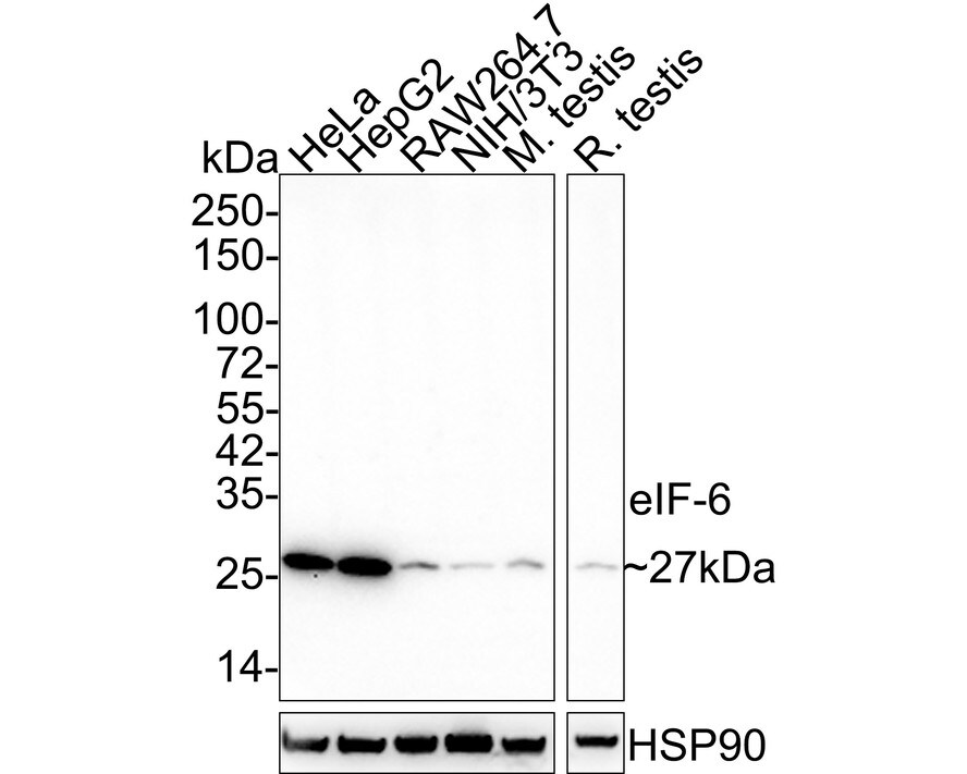 integrin beta 4 binding protein Antibody (A6A2-R) Western Blot: integrin beta 4 binding protein Antibody (A6A2-R) [NBP3-32304]