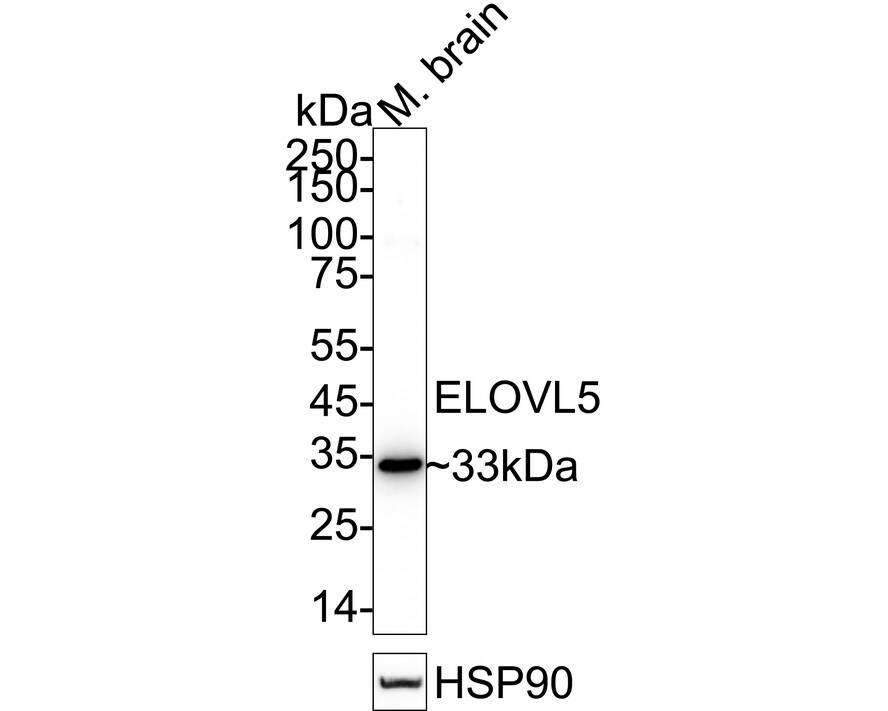 ELOVL5 Antibody (JE65-70) Western Blot: ELOVL5 Antibody (JE65-70) [NBP3-32305]