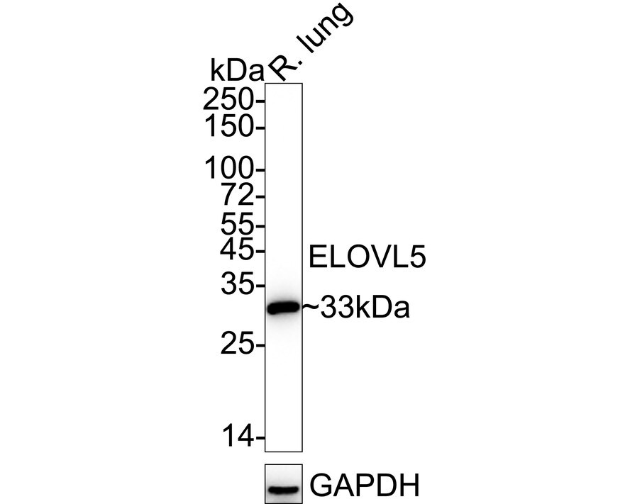 ELOVL5 Antibody (JE65-70) Western Blot: ELOVL5 Antibody (JE65-70) [NBP3-32305]