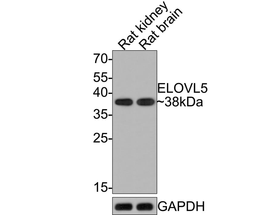 ELOVL5 Antibody (JE65-70)